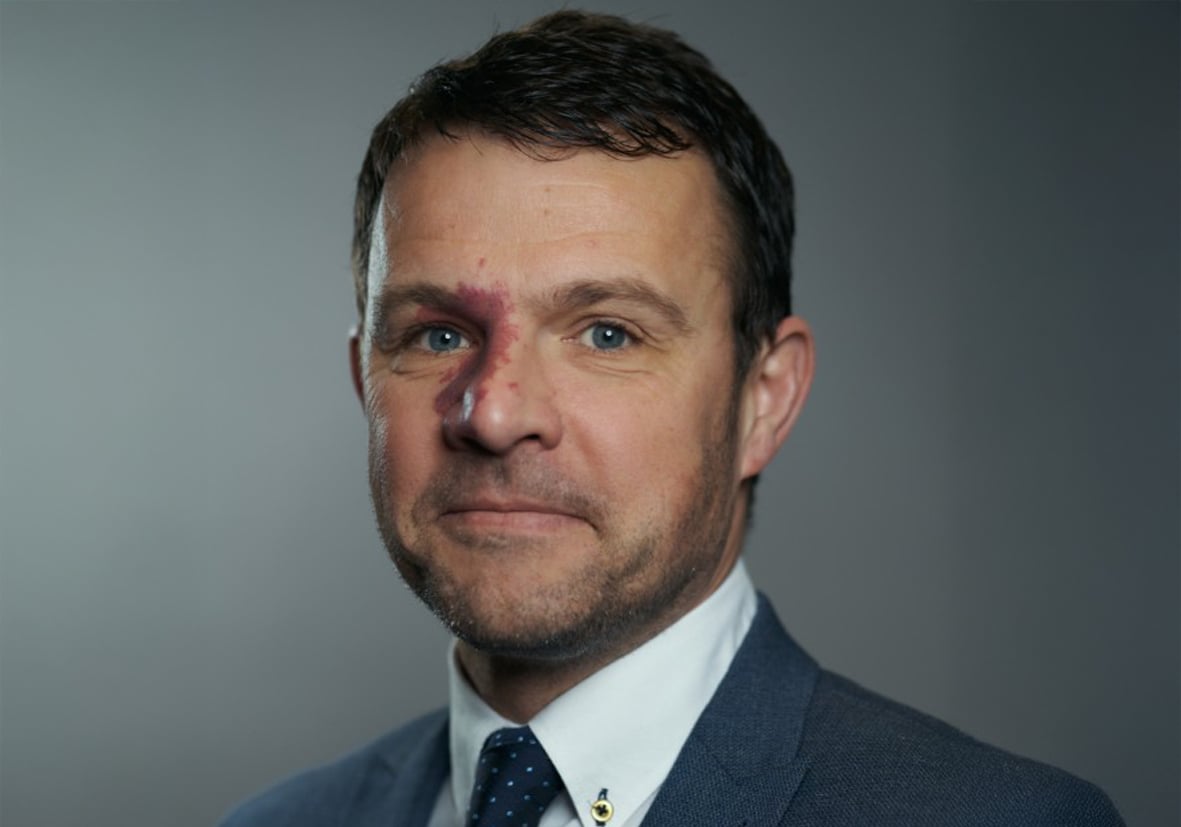 MArk-Culshaw